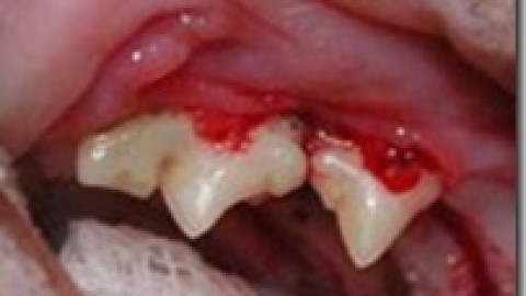 Riassorbimento Dentale Nel Gatto (FORL-Feline Odontoclastic Resorptive Lesions)