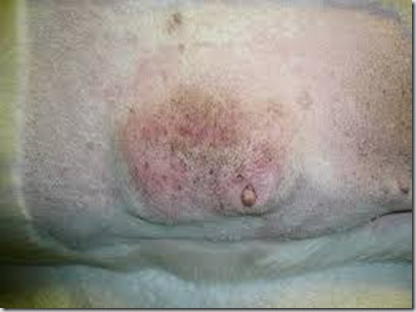 tumore mammario cagna 1