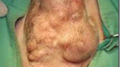Il Tumore Mammario nella Cagna