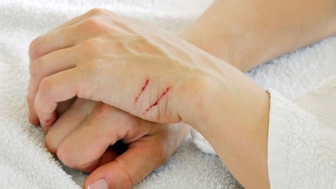 Graffi dei Gatti su Corpo Umani, Attenzione C'è il Rischio Bartonellosi – Tutta Salute