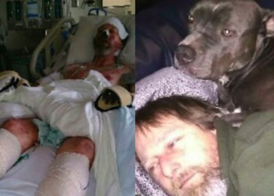Il cane lo lecca: gli amputano braccia, gambe e naso – FOTO – CheDonna.it