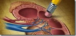 ckd